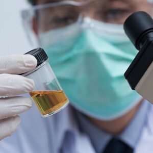 Urine Routine And Microscopy test