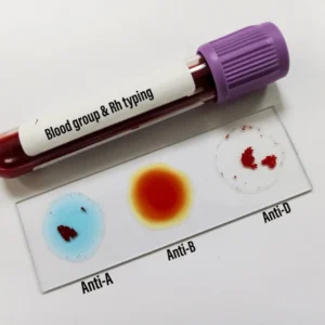 Blood Group Test